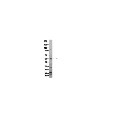 62-8388-21　［Discontinued］Anti-IRAK4, C-terminus; 100 μg　07-1602