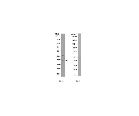 62-8502-11　［Discontinued］Anti-SSTR5/SS5R (P335L mutation) Antibody, clone D2F2 MABC528　MABC528
