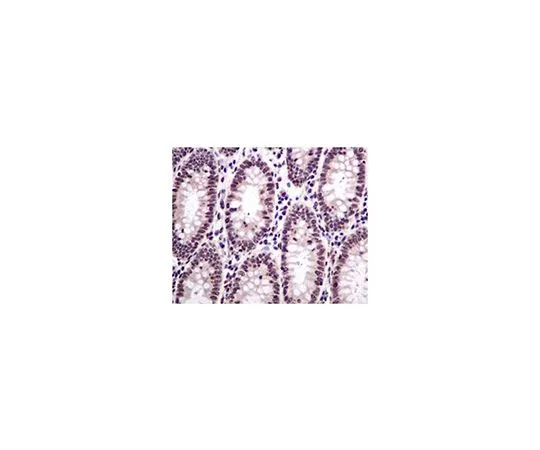 62-8506-72　［Discontinued］Anti-HMGN2, clone EPR7091, Rabbit Monoclonal　MABE596