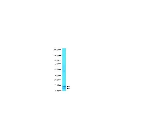 62-8450-33　［Discontinued］Anti-Somatostatin; 100 μg　AB5494