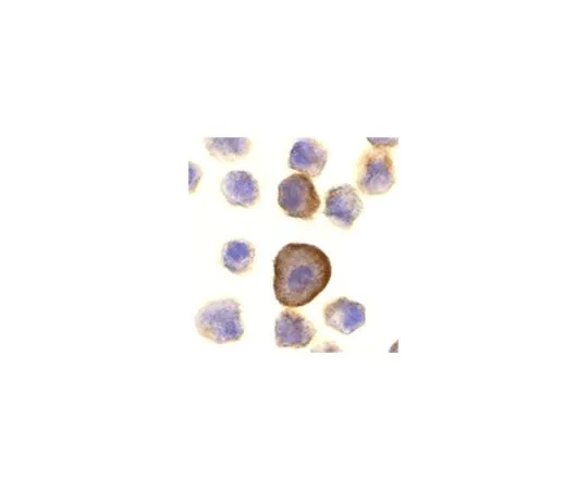 62-8462-45　［Discontinued］Anti-PERP　ABE606