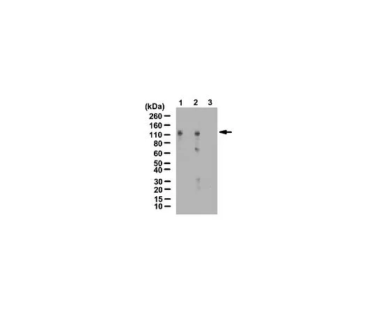62-8388-15　［Discontinued］Anti-HIF-1-alpha, hydroxyproline (Pro402); 100 μg　07-1585