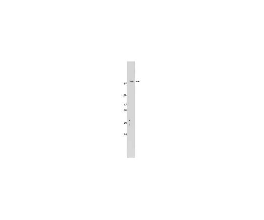 62-8368-33　［Discontinued］Anti-Sterol Regulatory Element Binding Protein 2 (SREBP-2), clone 2545; 200 μL　04-479