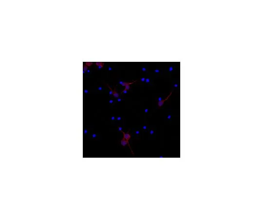 62-8494-86　［Discontinued］Anti-MAP2, clone AP20, Cy3 Conjugate; 100 μL　MAB3418C3
