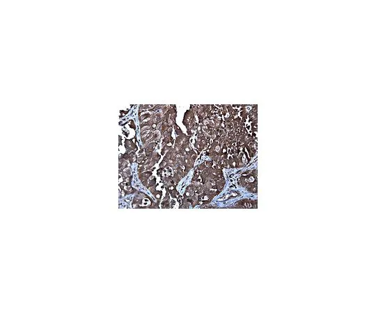 62-8382-98　［Discontinued］Anti-RelB; 100 μg　06-1105