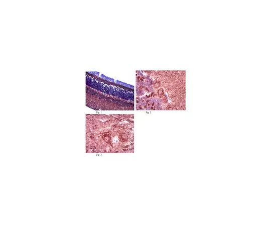 62-8465-71　［Discontinued］Anti-OPA1; 100 μg　ABN95