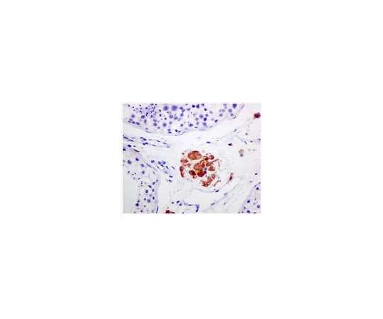 62-8523-58　［Discontinued］Anti-Cytochrome P450 17A1, clone EPR6294(2), Rabbit Monoclonal　MABS801