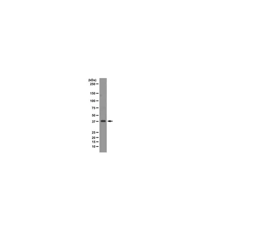 62-8374-81　［Discontinued］Anti-PURA, clone 2B7; 100 μg　05-1361