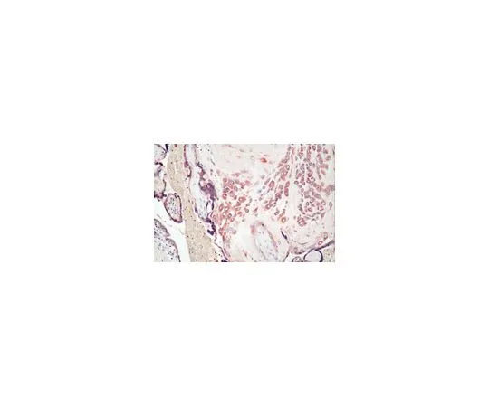 62-8500-30　［Discontinued］Anti-MMP-7, clone ID-2; 100 μg　MAB13414