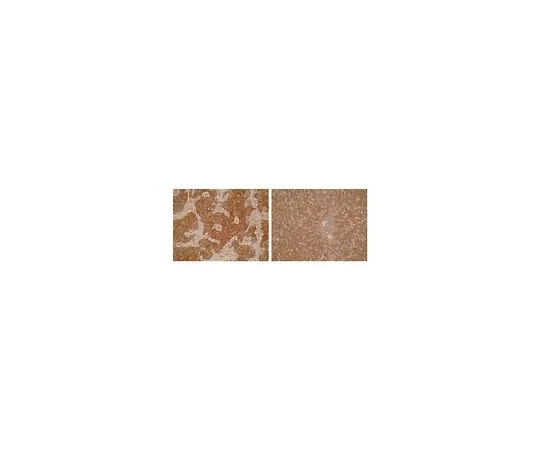 62-8518-78　［Discontinued］Anti-LRAT Antibody, clone M34-P1F10 Cat. No. MABN644　MABN644