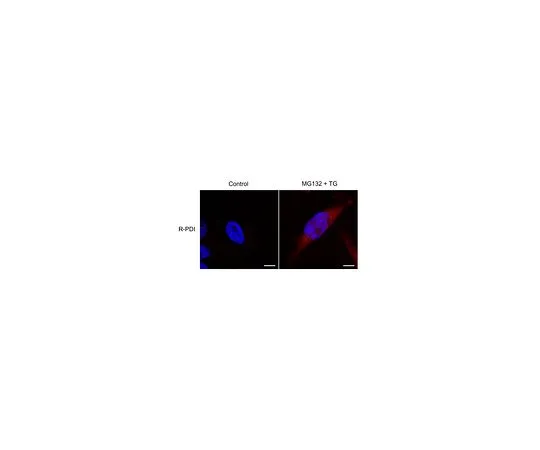 62-8471-97　［Discontinued］Anti-PDI Antibody, arginylated (Nt-Asp18)　ABS1655