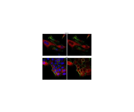 62-8456-78　［Discontinued］Anti-Argininosuccinate synthase; 100 μg　ABC108