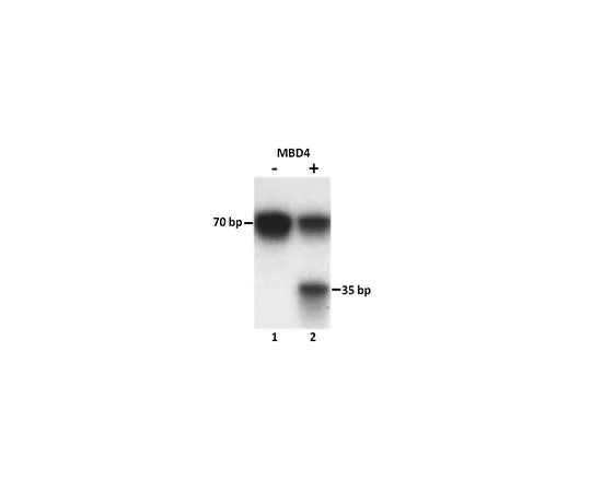 62-8391-93　［Discontinued］Human Recombinant MBD4, 10 ug　14-1065