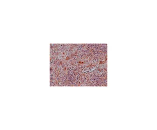 62-8465-03　［Discontinued］Anti-ABIN3 Antibody ABF287　ABF287