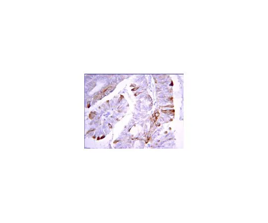 62-8387-26　［Discontinued］Anti-DAPK2; 100 μg　07-1229