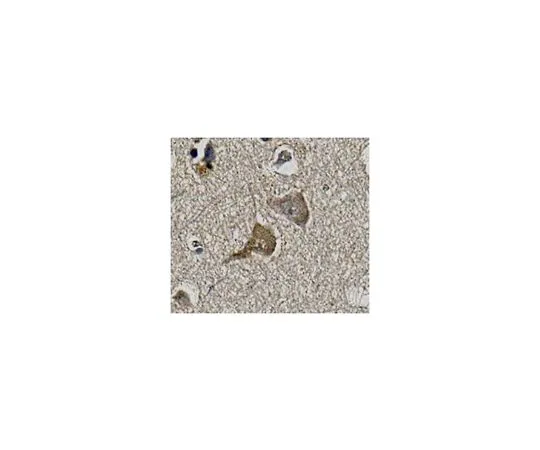 62-8518-89　［Discontinued］Anti-KvBeta1, clone K40/17　MABN658