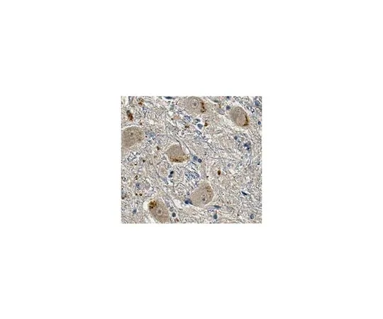 62-8518-70　［Discontinued］Anti-LRRK2 Antibody, clone 8G10 Cat. No. MABN636　MABN636
