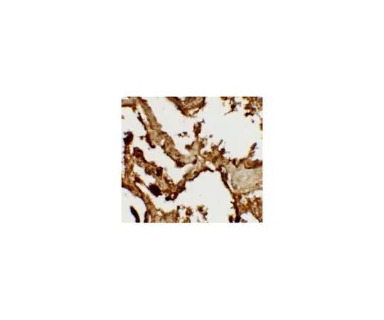 62-8457-63　［Discontinued］Anti-VKORC1　ABC325