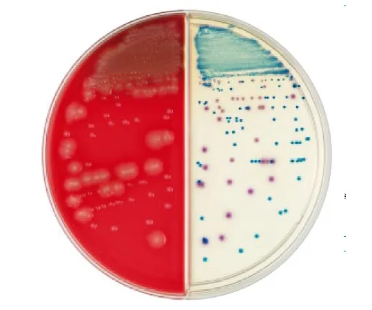 63-6527-88 BD BBL (TM) TSAII 5% sheep blood agar/CHROMagar (TM) orientation agar 100 sheets 252075