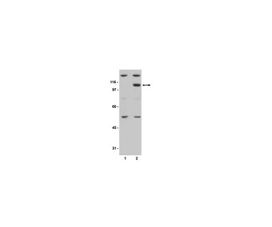 62-8384-77　［Discontinued］Anti-phospho-PKD2 (Ser876); 200 μg　07-385