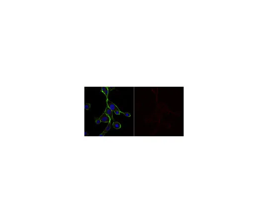 62-8370-55　［Discontinued］Anti-Cortactin (p80/85) Antibody, clone 4F11, Alexa Fluor(R) 647 Conjugate　05-180-AF647