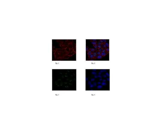 62-8462-92　［Discontinued］Anti-TIF1-beta　ABE1023