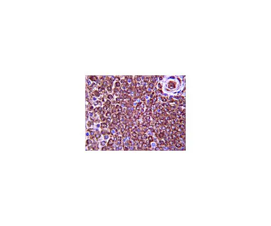 62-8388-73　［Discontinued］Anti-PI3 Kinase-C2β; 100 μg　7-70
