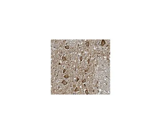 62-8517-63　［Discontinued］Anti-hEag1 Potassium Channel, clone 62　MABN377