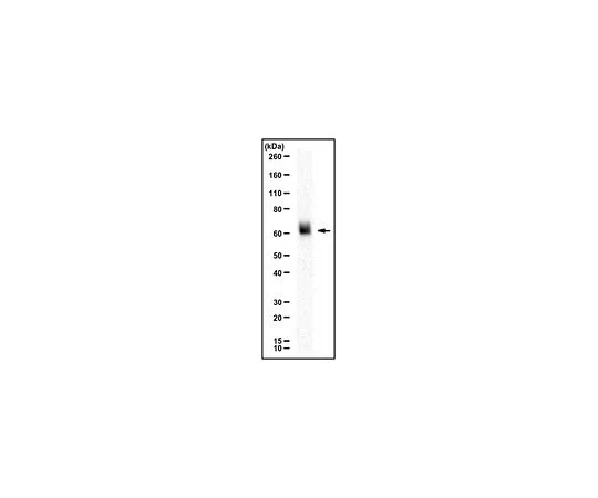 62-8467-99　［Discontinued］Anti-ENTPD1 Antibody　ABN1008