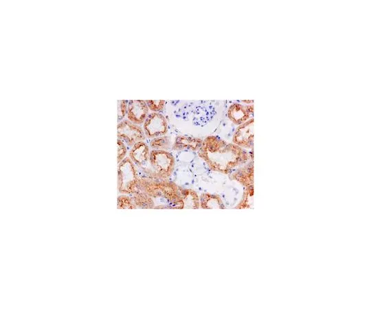 62-8503-13　［Discontinued］Anti-Cathepsin S, clone EPR5128, Rabbit Monoclonal　MABC755