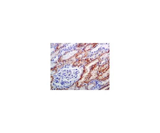 62-8503-27　［Discontinued］Anti-phospho-NDRG1 (Ser330), clone EPR5594, Rabbit Monoclonal　MABC774