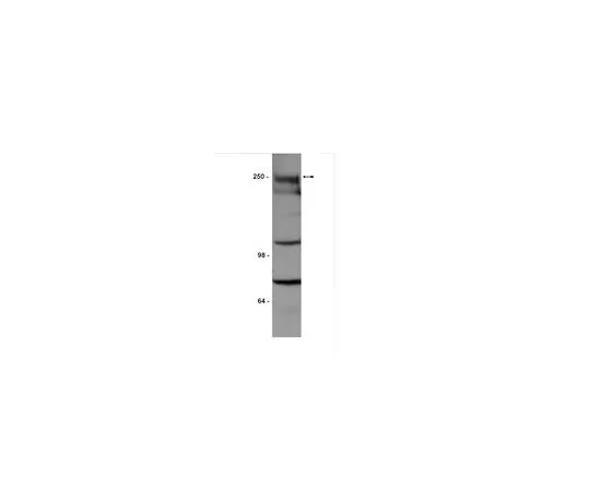 62-8384-10　［Discontinued］Anti-Notch1, extracellular domain; 100 μg　07-218