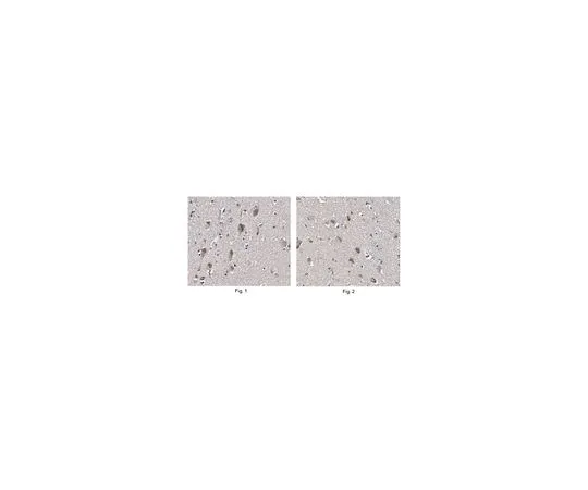62-8518-09　［Discontinued］Anti-Clcn3 Antibody, clone N258/5 Cat. No. MABN490　MABN490