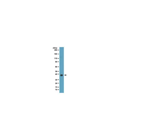 62-8374-64　［Discontinued］Anti-Bmi-1, clone DC9; 100 μg　05-1322
