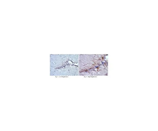 62-8500-15　［Discontinued］Anti-Plexin B3, clone 17H10.1; 100 μg　MAB10424