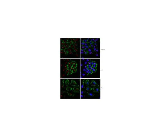 62-8390-13　［Discontinued］Anti-PHD finger protein 8; 200 μL　09-868