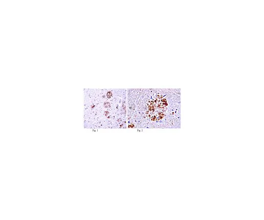 62-8499-62　［Discontinued］Anti-Amyloid beta A4 protein, clone MM26-2.1.3; 100 μg　MAB8768