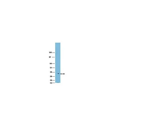 62-8454-16　［Discontinued］Anti-PHB2; 100 μg　AB10198