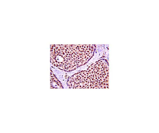 62-8389-62　［Discontinued］Anti-phospho-AMPK1 (Thr174); 100 μg　09-290