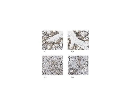 62-8457-18　［Discontinued］Anti-WISP-1　ABC223