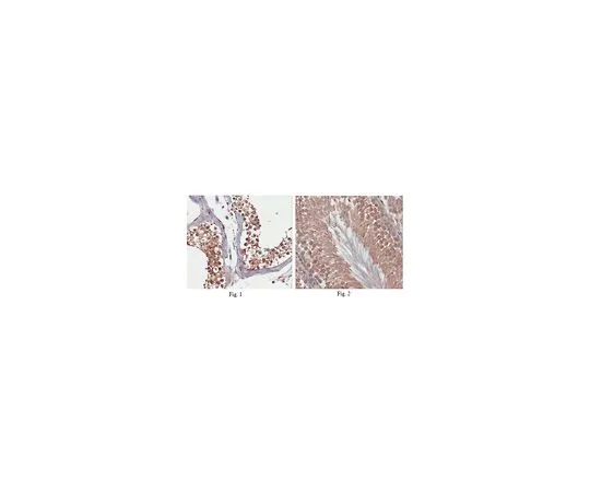 62-8465-93　［Discontinued］Anti-MMEL1 Antibody ABN165　ABN165