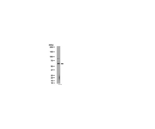 62-8446-52　［Discontinued］Anti-SUR1; 100 μg　AB2241