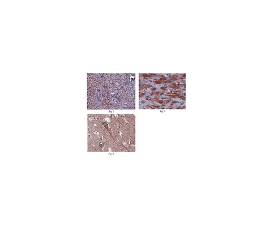 62-8465-92　［Discontinued］Anti-IL22RA2 Antibody　ABN164