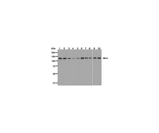 62-8520-48　［Discontinued］Anti-UBE4B, clone EPR7471, Rabbit Monoclonal　MABN1152