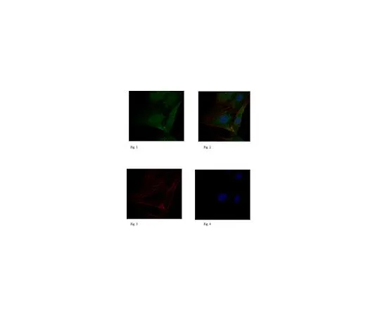 62-8470-44　［Discontinued］Anti-AKAP-12　ABS510