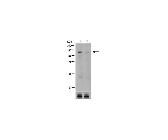 62-8503-03　［Discontinued］Anti-phospho-ULK1 (Ser623), clone EPR6154, Rabbit Monoclonal　MABC734