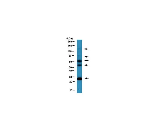 62-8518-43　［Discontinued］Anti-Neuregulin-HBD, Type I/II Antibody, clone N120A/9 Cat. No. MABN536　MABN536