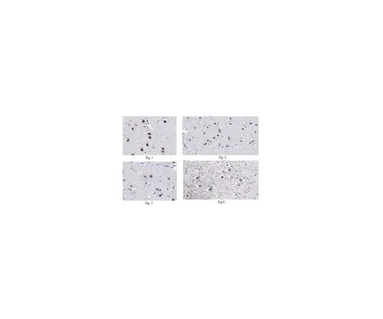 62-8504-25　［Discontinued］Anti-Achaete-scute homolog 1 Antibody, clone 6D8.1 MABD64　MABD64