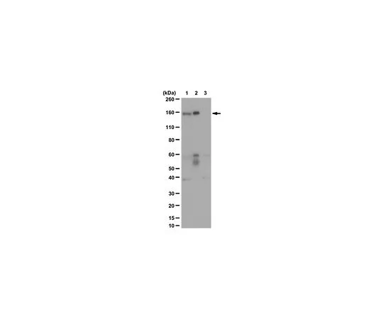62-8473-15　［Discontinued］Anti-DSG2 Antibody Cat. No. ABT181　ABT181