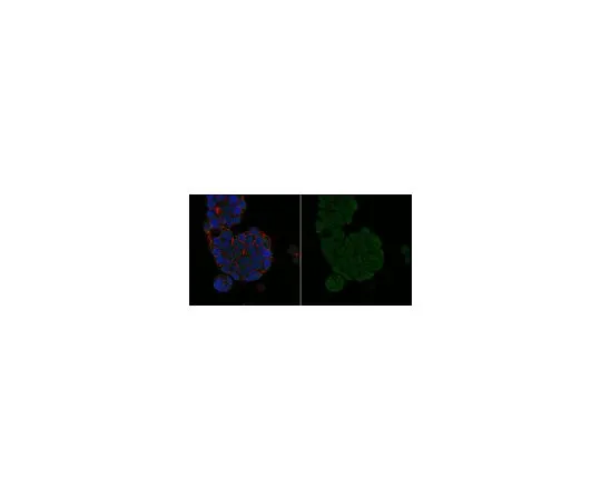 62-8500-44　［Discontinued］Anti-MGMT Antibody, clone MT 3.1, Alexa Fluor(R) 488 Conjugate　MAB16200-AF488